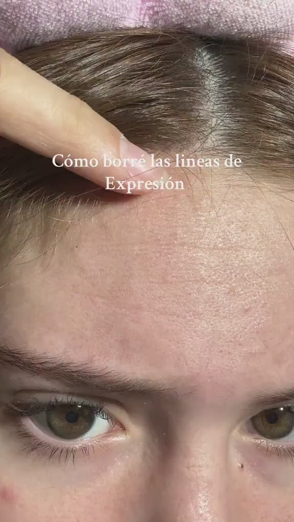 💥Buy one, get one free💥 Authentic Retinol Serum Black Ginseng + Niacinamide + Vitamin C Anti-Aging Ampoule for Firm video