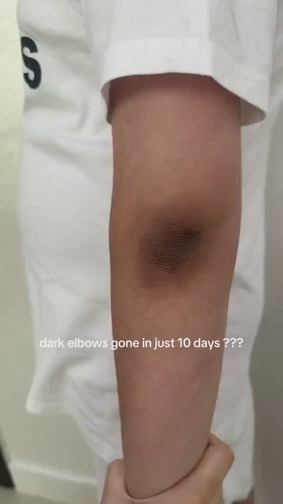 💥Buy one, get one free💥 Authentic Retinol Serum Black Ginseng + Niacinamide + Vitamin C Anti-Aging Ampoule for Firm video