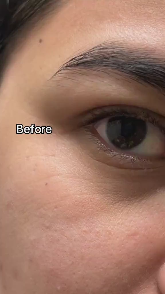 Cream for dark circles and puffiness blushyco 💥Buy two, get One free💥 video